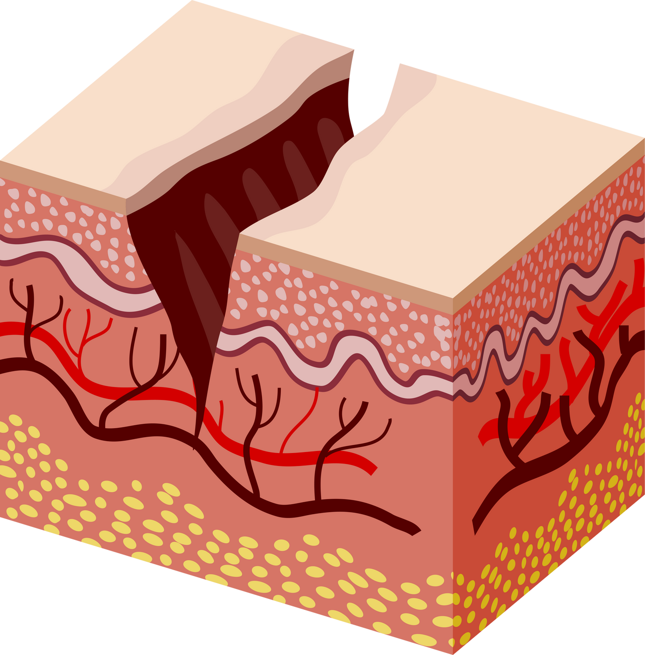 Fissure Skin Layers