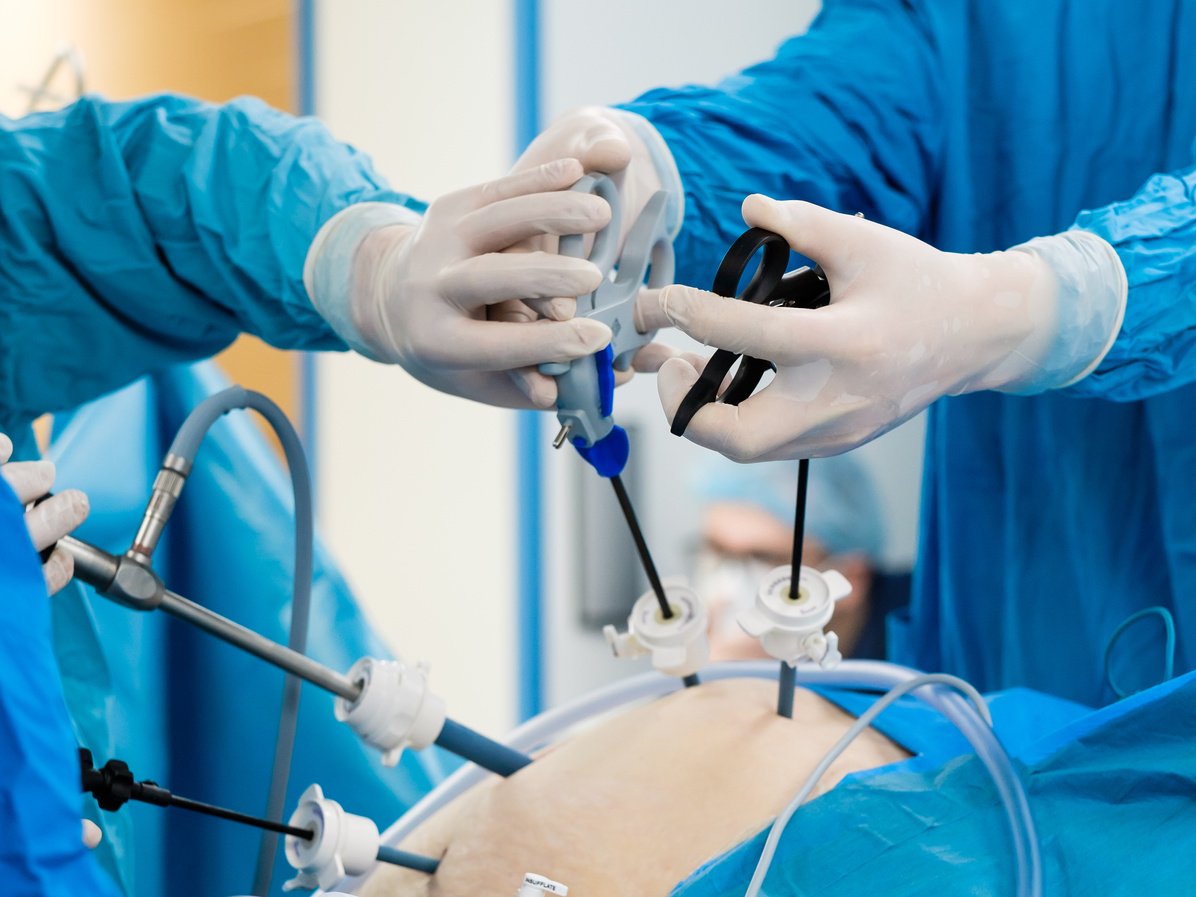 The hands of surgeons in latex gloves and blue uniforms hold special medical instruments during laparoscopic minimally invasive surgery.