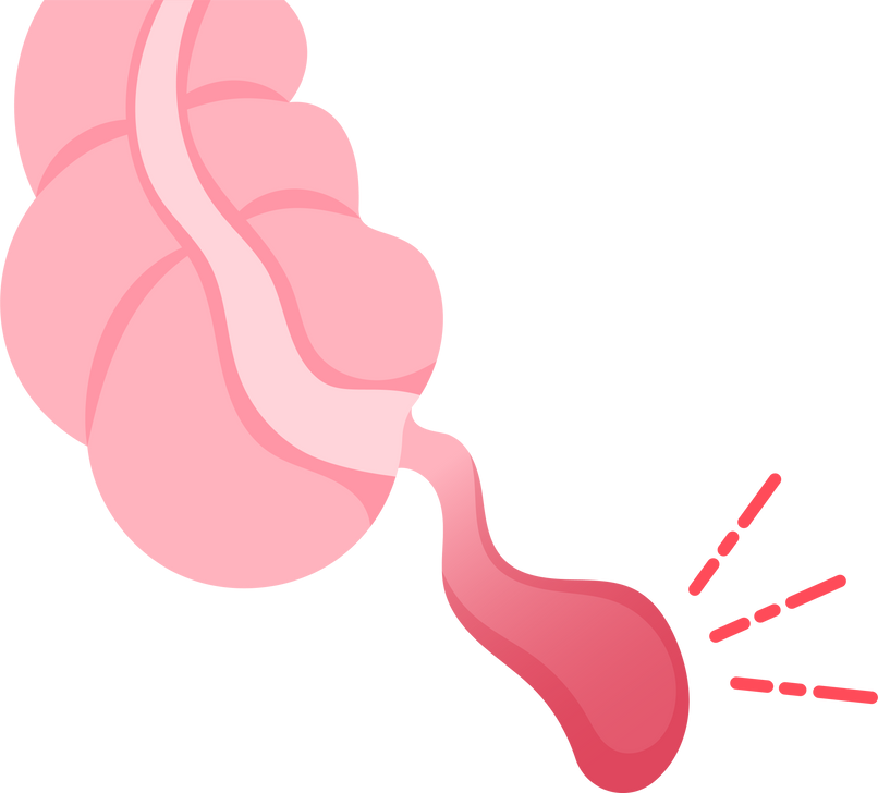 Acute colon infection pain Abdominal swollen